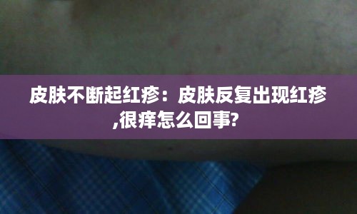 打张鸡儿 第2页